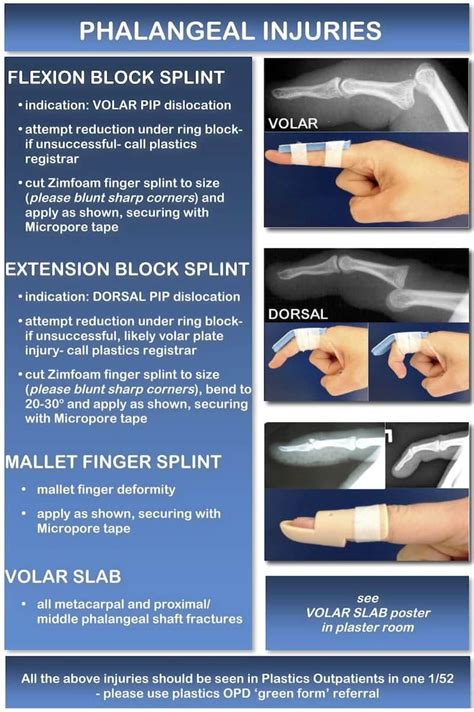 Cpt Code For Volar Finger Splint