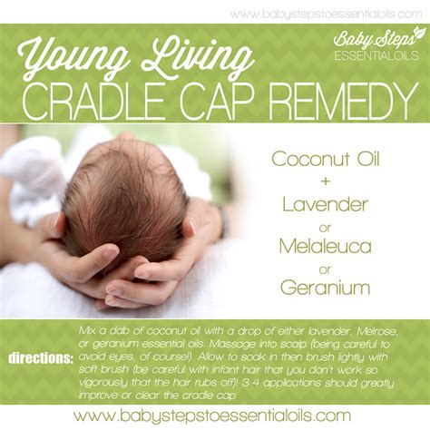 cradle cap baby oil
