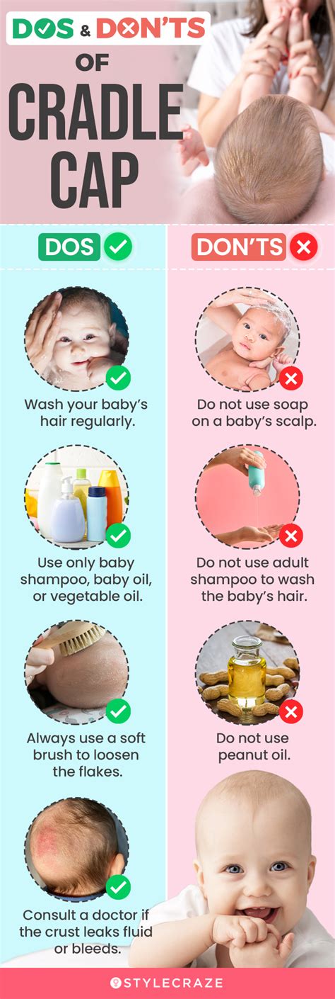 Cradle Cap For Toddlers