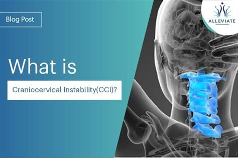 craniocervical instability life expectancy