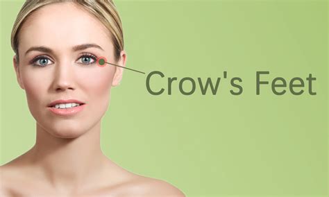 crow's feet meaning