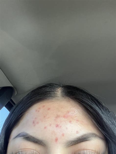 Crushing Zoloft Reddit