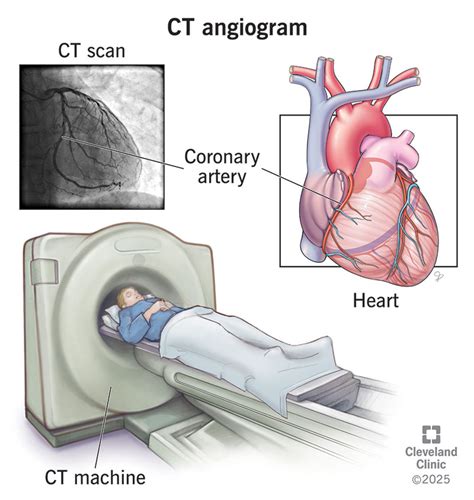 CT Angiogram and Angiography: Diagnostic Imaging Breakthroughs Unveiled