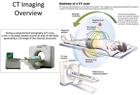 What Is a CT Cat Scan and Its Benefits?