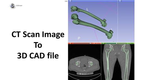 Ct Scan Data To 3D Model