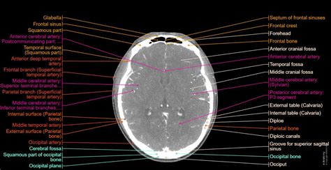 Understanding a CT Scan of Head: What Do the Results Mean?