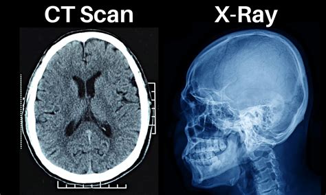 Understanding CT vs X Ray Difference for Better Medical Imaging