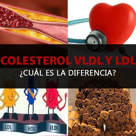 cual es el colesterol vldl