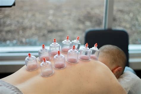 Cupping Timing Guide