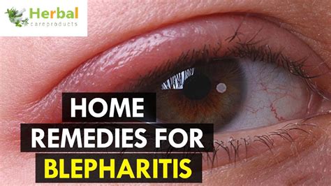 Discover the Ultimate Cure for Blepharitis: Breakthrough Treatments for Lasting Relief
