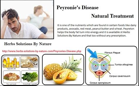 cure peyronie's disease with supplements