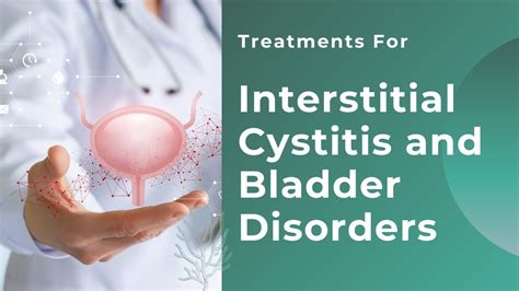 cures for interstitial cystitis