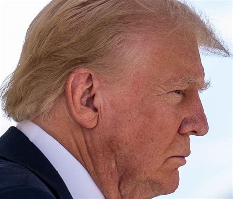 current pictures of trumps ear