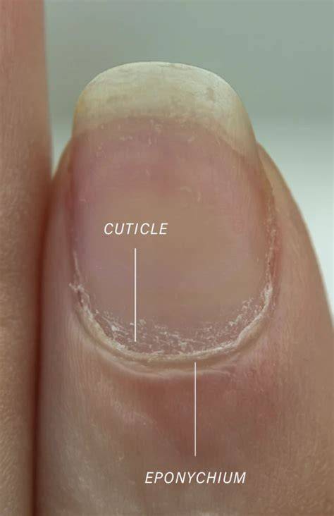 Cuticle Care