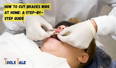 Cutting A Braces Wire