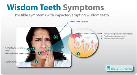 cutting wisdom teeth symptoms