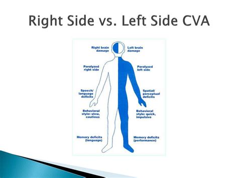 cva on right side of brain