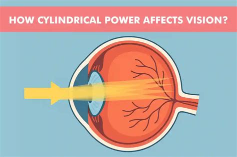 Cylindrical Power Causes