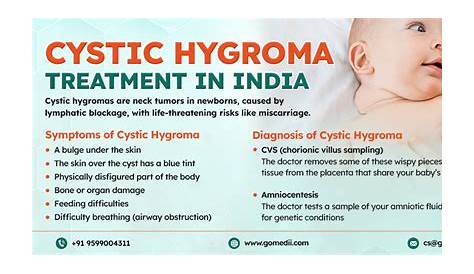 Cystic Hygroma Treatment In India Surgical Of tracranial Arachnoid Cyst Adult