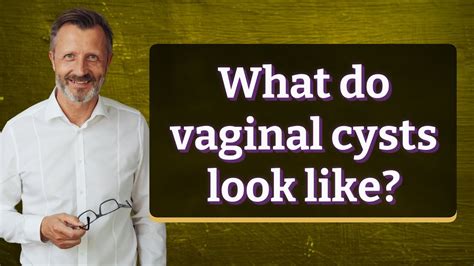 Understanding Cysts of Vulva: Causes, Symptoms, and Effective Treatment Options