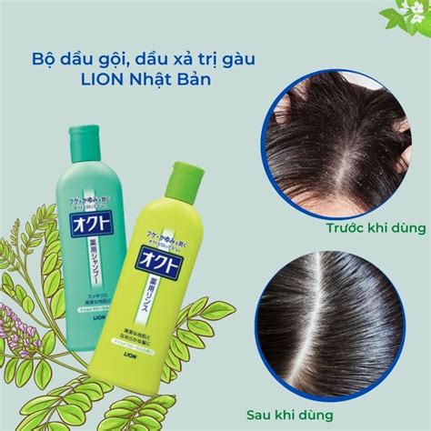 dầu gội đầu trị gầu