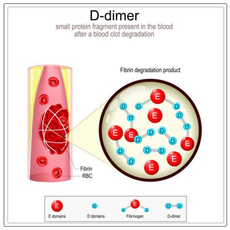 D Dimer Definition