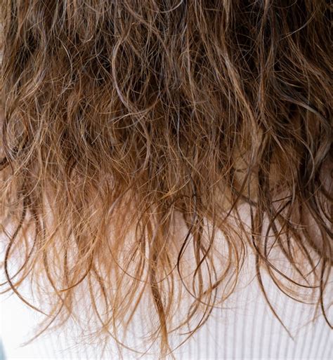 Damage Hair Fall Out  Causes  Prevention  And Treatments