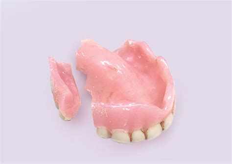 Damaged Denture Repair San Antonio TX