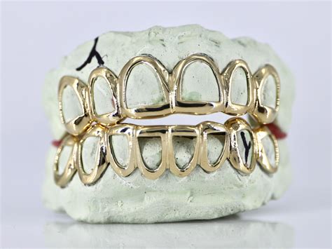 Damaged Gold Grillz