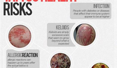 5 dangerous health risks of tattoos | Health24