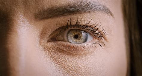 What Is a Dark Spot in Eye and Its Causes?