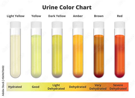 Dark Urine