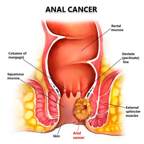 day 3 anal