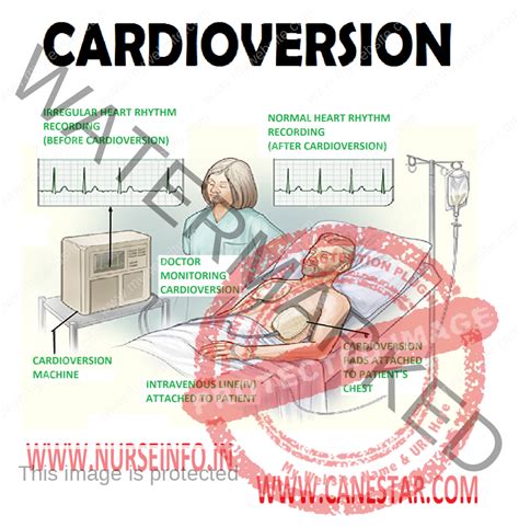 dc-kardioversion