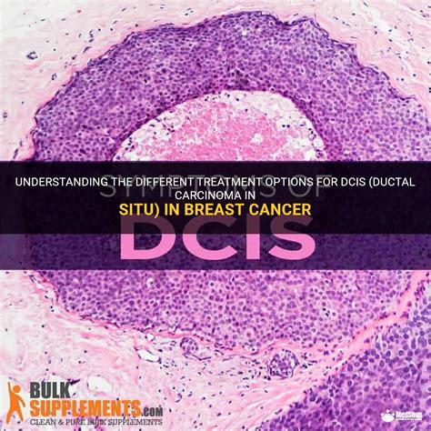 dcis breast cancer treatment options