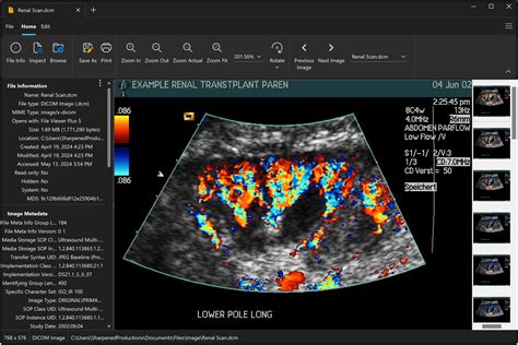 dcm file viewer install