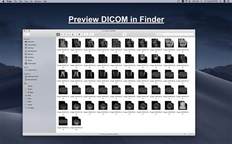 dcm file viewer windows 10