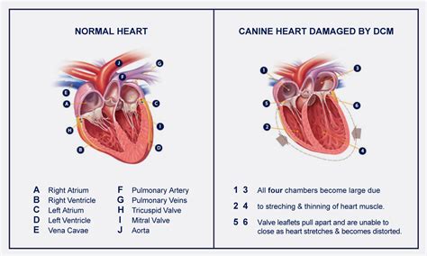 dcm heart disease in dogs
