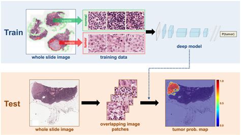 deep learning and optimization algorithms for automatic breast cancer detection