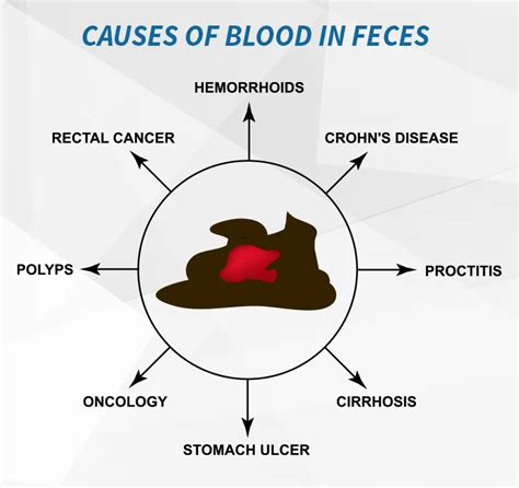 Defecating Blood: What Are the Common Causes and When to Seek Help