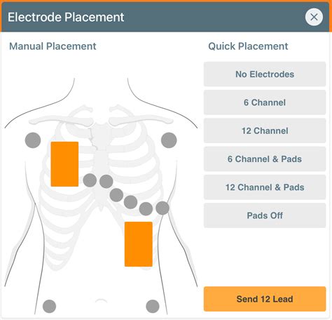 Defibrillator Electrodes Placement