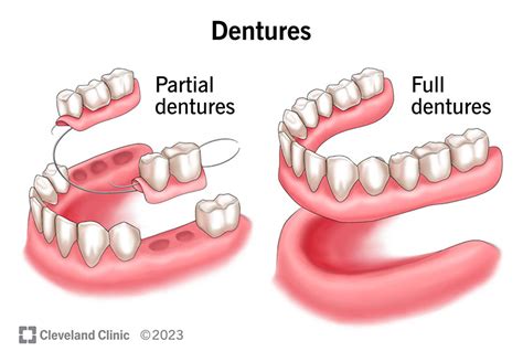 Define Dentures And Explain Care Guidelines Crossword