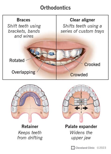 Define Orthodontics Dentistry