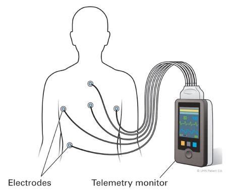 5 Ways Telemetry Unit