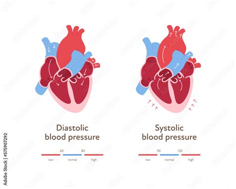 Was ist Bluthochdruck? BluthochdruckSymptome