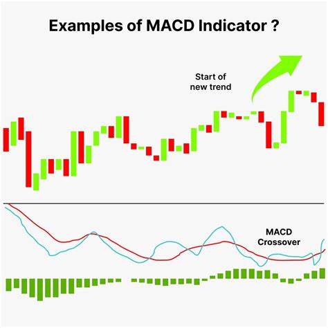 definition of macd