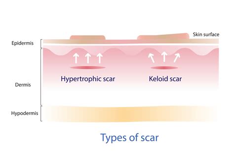 Definition Scar