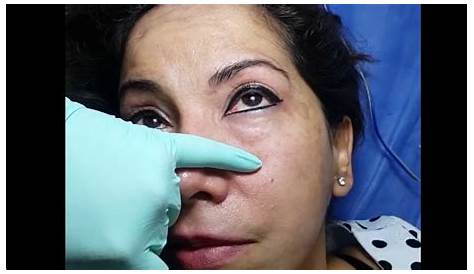 DELINEADO DE OJOS PERMANENTES SIN.DOLOR YouTube