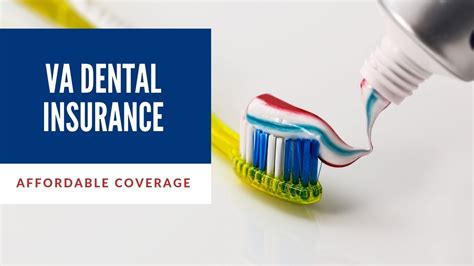 Expert Dentist Accepts Delta Dental PPO Insurance Frisco, TX Dental