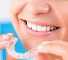 delta dental invisalign coverage for adults